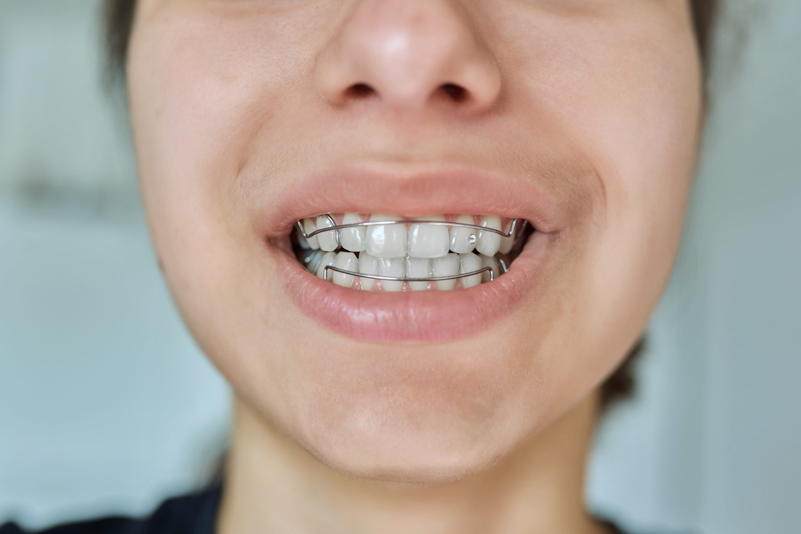 Functional Appliances