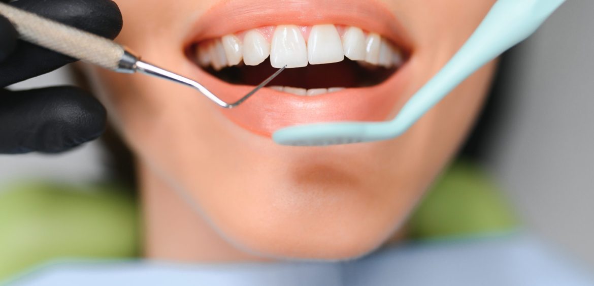 Beautiful Smile With White Teeth. Closeup Of Smiling Woman Mouth With Natural Plump Full Lips And Healthy Perfect Smile.